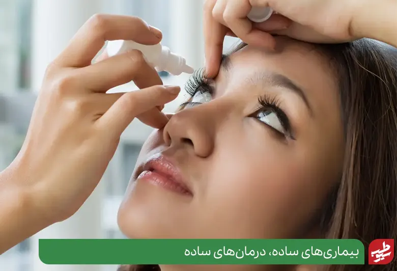 درمان آبریزش چشم با استفاده از قطره چشمی|سیوطب