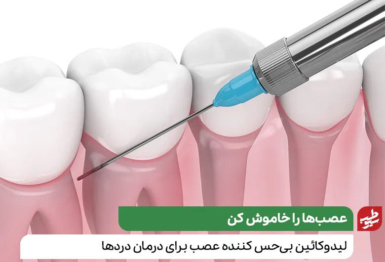 تزریق لیدوکائین در دندان سیوطب