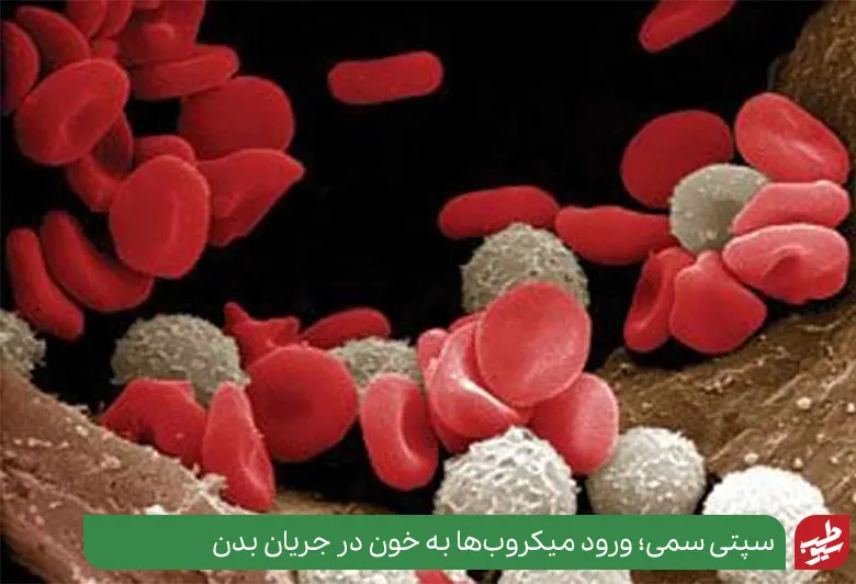 سلول‌های خونی در حال مبارزه با عفونت در خون|سیوطب
