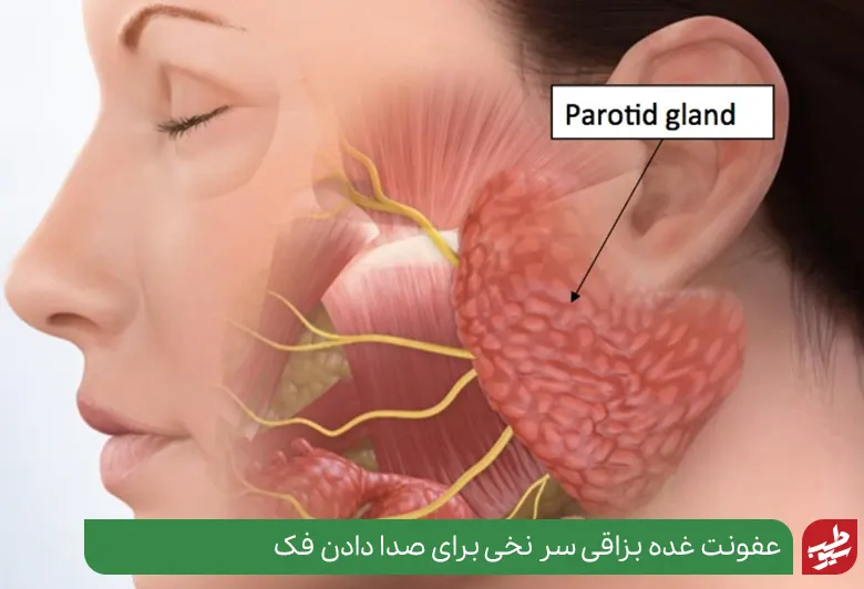 درمان صدا دادن فک با رفع عفونت در آناتومی غده بزاقی|سیوطب