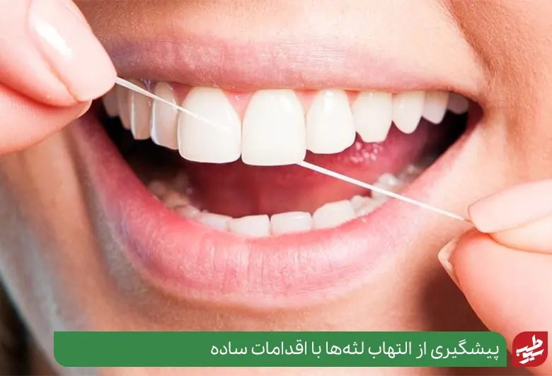 جلوگیری از التهاب لثه با نخ دندان کشیدن|سیوطب