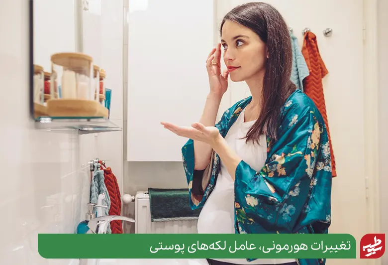 علت تیرگی پوست دور دهان، تغییرات هورمونی