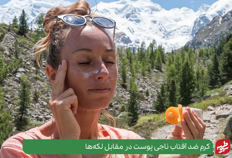 چاره تیرگی پوست دور دهان سیوطب