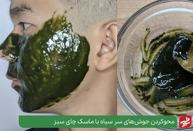 از بین بردن جوش سر سیاه با ماسک چای سبز|سیوطب