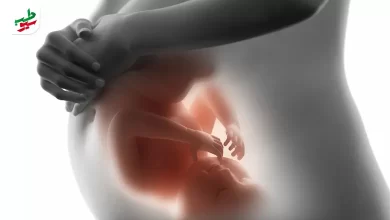 علائم بارداری پسر در ماه اول چیست؟|سیوطب
