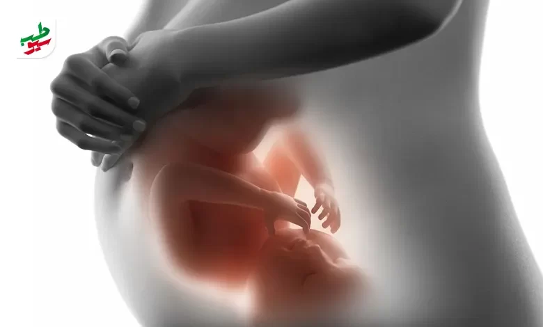علائم بارداری پسر در ماه اول چیست؟|سیوطب