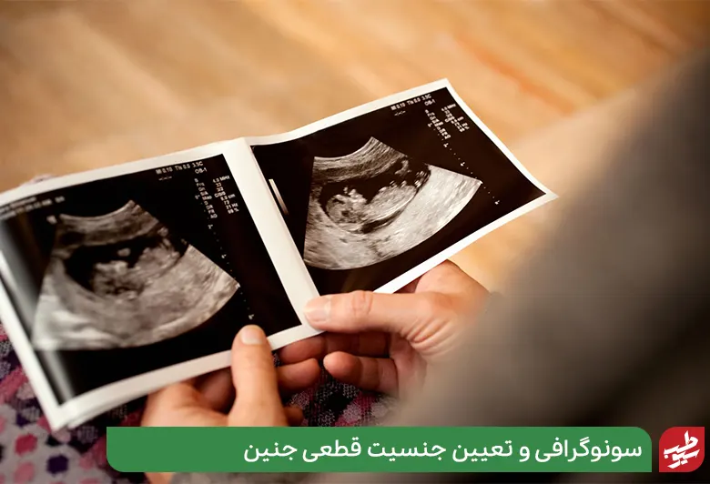 سونوگرافی برای تعیین جنسیت جنین|سیوطب