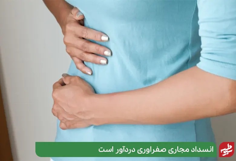 علائم شدید سنگ صفرا|سیوطب