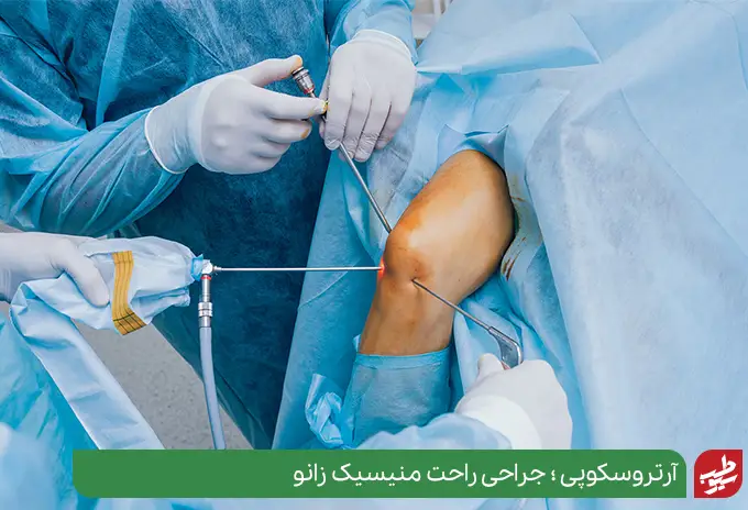 جراحی آرتروسکوپی برای درمان مینیسک زانو|سیوطب