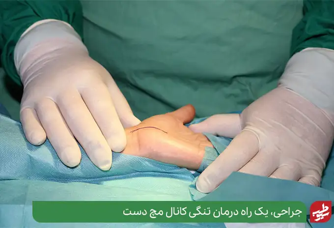 جراحی، یک راه درمان تنگی کانال مچ دست|سیوطب