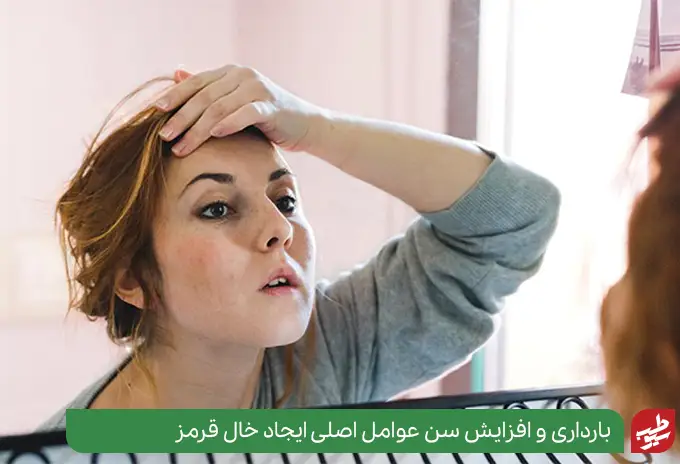 خانم بارداری که خال قرمز روی بدنش به وجود آمده است|سیوطب