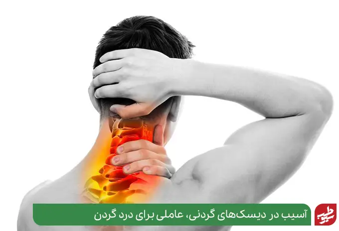 علت گردن درد هنگام خوابیدن به دلیل دیسک گردن|سیوطب