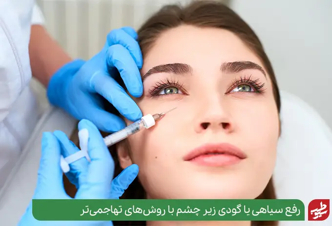 رفع گودی و سیاهی زیر چشم با تزریق دارو|سیوطب