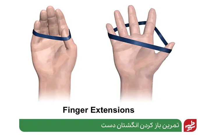 تمرین باز کردن انگشتان دست برای رفع انگشتان ماشه ای|سیوطب