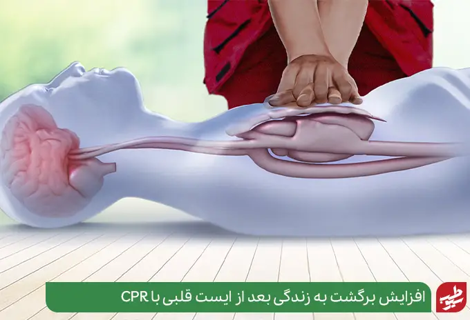 CPR مرگ بر اثر ایست قلبی را کاهش می‌دهد|سیوطب