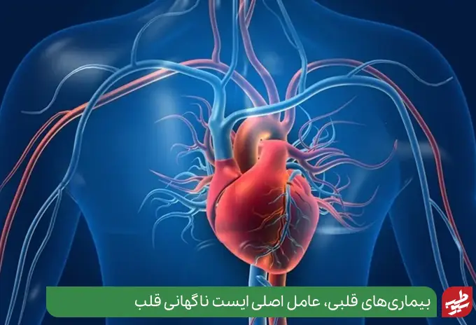 علت ایست قلبی در اغلب موارد بیماری‌های قلبی شدید است|سیوطب