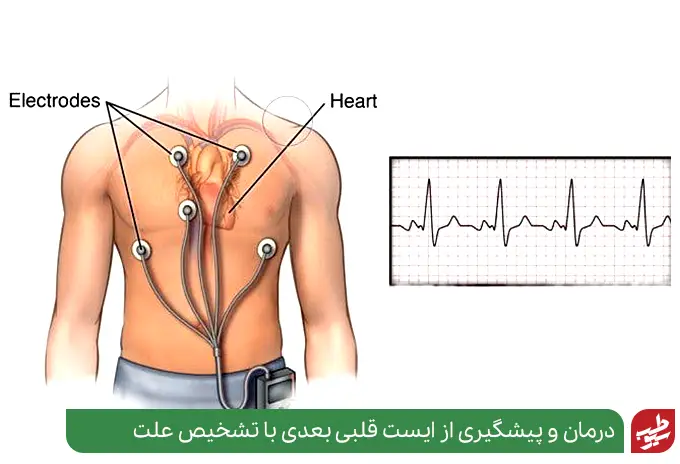 تشخیص آسیب‌های بعد از ایست قلبی با ECG|سیوطب
