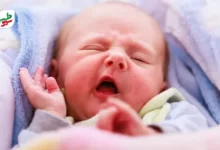نوزادی مبتلا به فلج ارب در حال گریه کردن|سیوطب