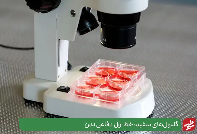 آزمایش گلبول‌های سفید و نیاز به تفسیر آزمایش عفونت خون|سیوطب