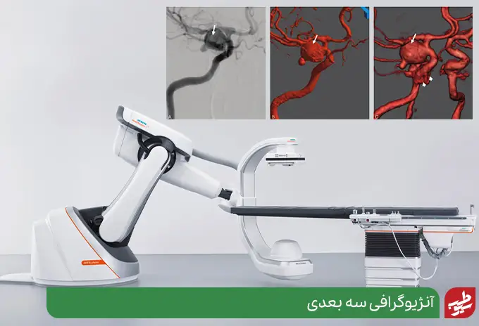 پذیرش بیمارستان میلاد تهران برای آنژیوگرافی سه بعدی|سیوطب