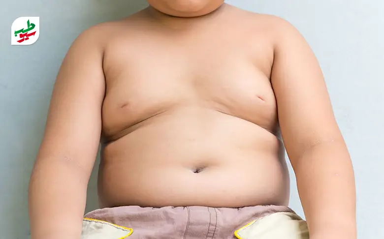 کودکی دارای اضافه وزن و نیاز به رژیم لاغری کودکان دارد|سیوطب