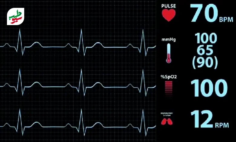 ضربان قلب نرمال باید در بازه 60 تا 100 ضربه در دقیقه باشد|سیوطب