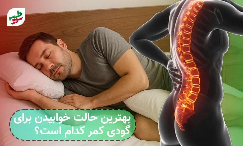 خوابیدن برای گودی کمر |سیو طب