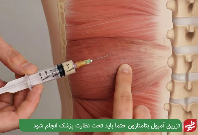 نحوه تزریق آمپول بتامتازون | سیو طب